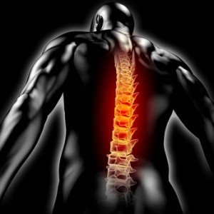 Rückenschmerzen - Rücken mit dem Röntgenbild der Wirbelsäule